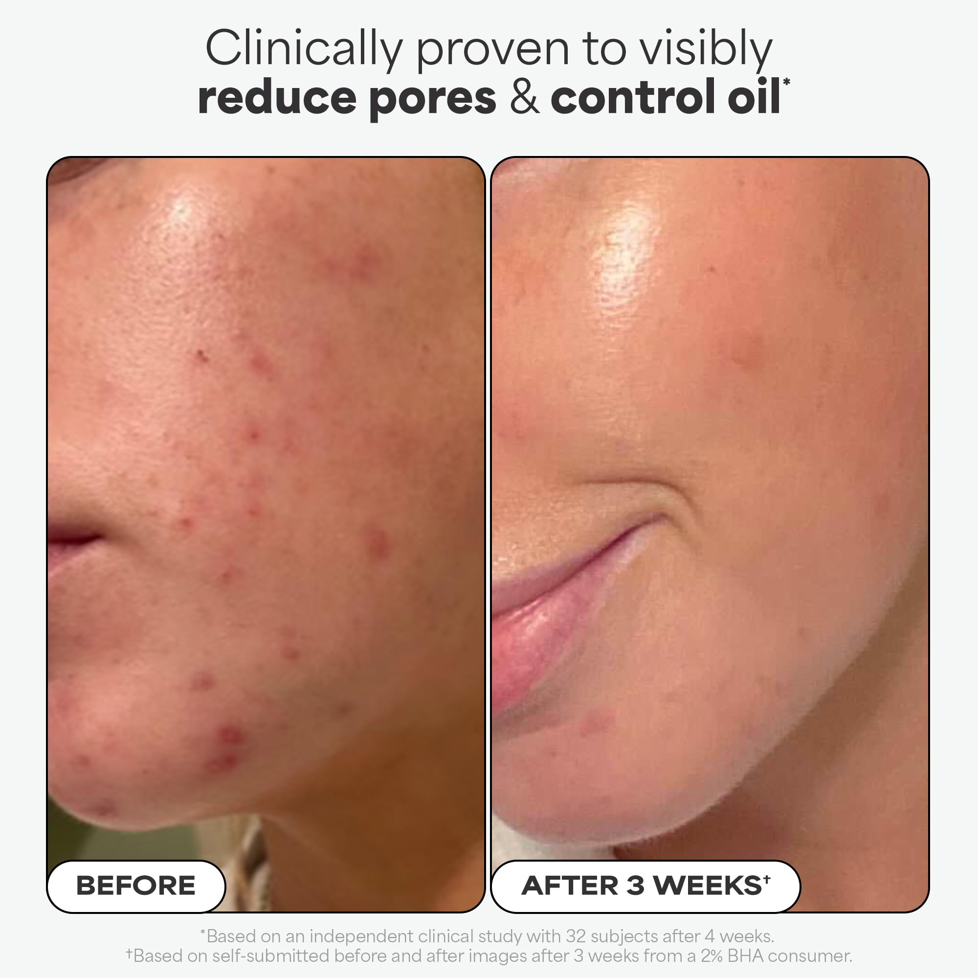 Paula's Choice SKIN PERFECTING 2% BHA Liquid Exfoliant with Salicylic Acid, Facial Polish for Enlarged Pores, Wrinkles & Fine Lines, Suitable for Blackhead-Prone Skin, Fragrance-Free